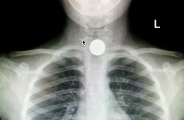 Новий небезпечний челендж у TikTok: дитина опинилася в лікарні